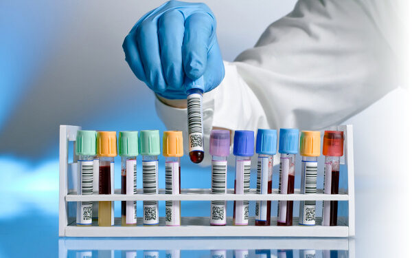 Diagnóstico de anemia: el rol clave del laboratorio y un enfoque multidisciplinario