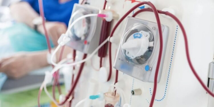 En Argentina, hay 30.000 pacientes en diálisis crónica